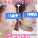 在快手平台投放广告的样式有哪些？