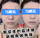 在快手平台推广广告开户时间需要多久？