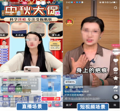 快手广告医美广告形式 快手广告医美广告形式